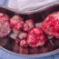 Understanding Fibroids